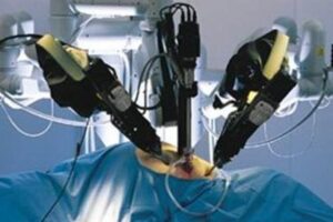 First Robotic Surgeon